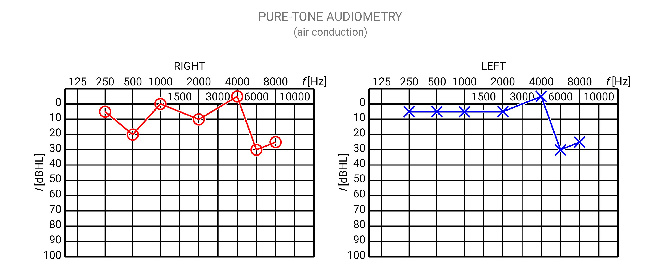 audiogram_20171129_125827.jpg
